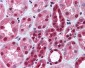 DNMT / DNMT1 Antibody (aa177-550)